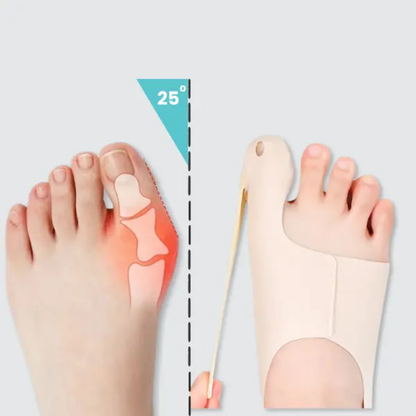 Bunion Corrector Orthopedic Sleeve