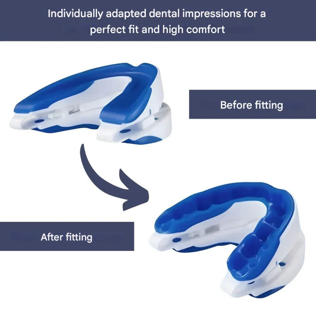 Snore Reducing Mouthpiece - Vonnera