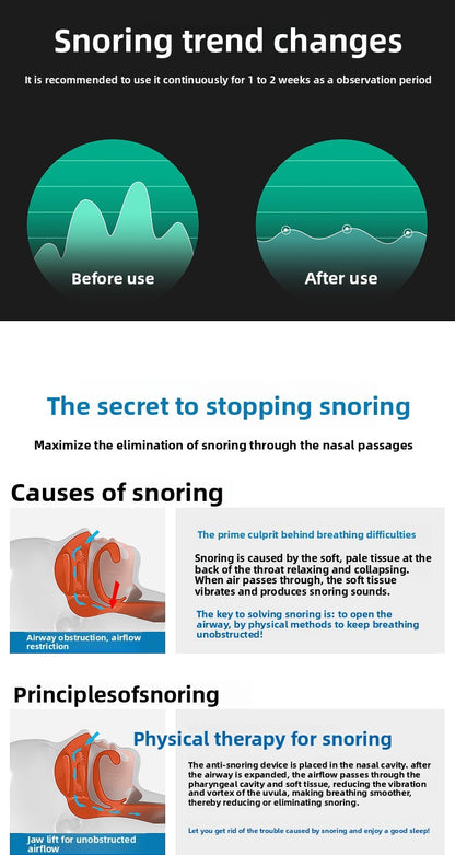 Snore Reducing Device For Quiet Sleep
