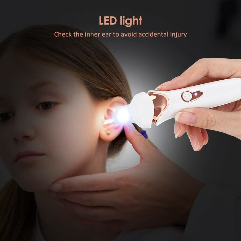 Ear Wax Vacuum Cleaner Painless - Vonnera